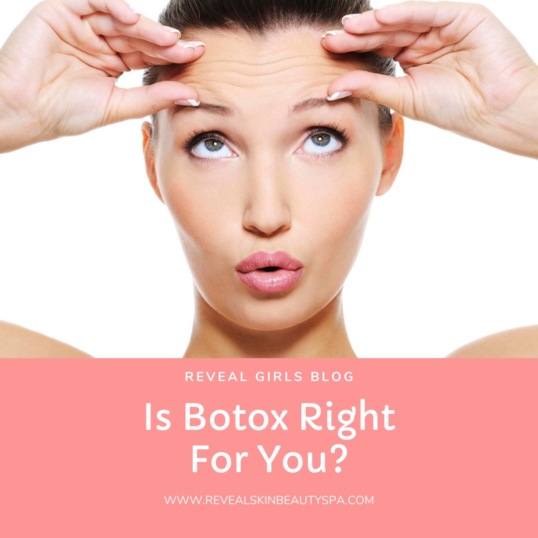 Is Botox Right for You?